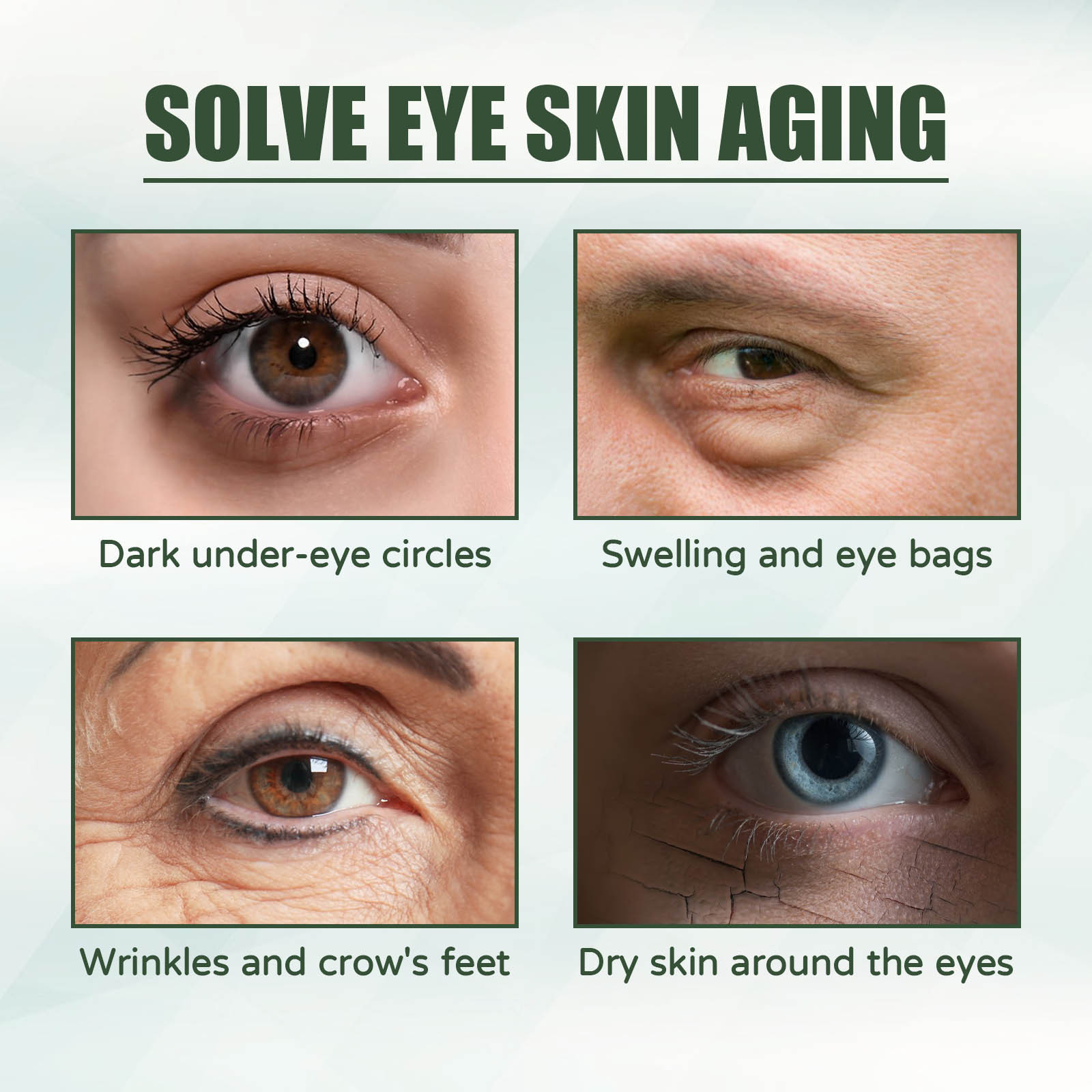 Eelhoe Anti-Aging-Augen creme  – Women Bags Under Eyes Bewertung und Preis